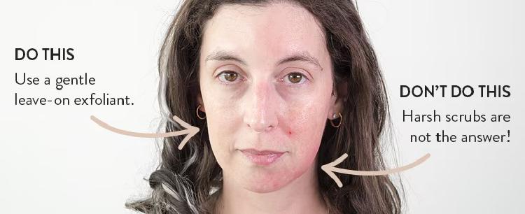 Balancing Act: Sunscreen, Retinol, and Exfoliants for Healthy Skin